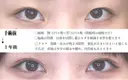 目頭切開法+埋没法 365日後 サムネイル用