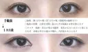 目頭切開 before画像 サムネイル用