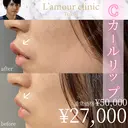 Cカールリップ after画像 サムネイル用