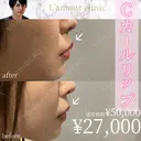 Cカールリップ after画像 サムネイル用