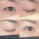 二重埋没法 after画像 サムネイル用