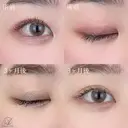 目頭切開 before画像 サムネイル用