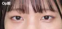 埋没法二重 before画像 サムネイル用