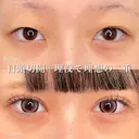 二重埋没法＋目頭切開 90日後 サムネイル用