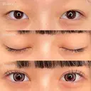 二重埋没法＋目頭切開 90日後 サムネイル用