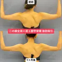 華奢な肩回りを作る💘美ボディ脂肪吸引 30日後 サムネイル用