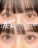 涙袋ヒアルロン酸 before画像 サムネイル用