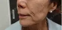 フェイスタイト before画像 サムネイル用