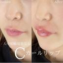 Cカールリップ after画像 サムネイル用