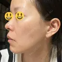 ルメッカ ルラ美容クリニック 渋谷本院 DAY 4 サムネイル用