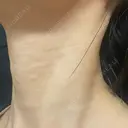 ヒアルロン酸注入（首） 湘南美容クリニック 京都院 DAY 28 サムネイル用