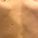 その他（ボディ） キハラ皮フ科 DAY 3 サムネイル用