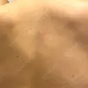 その他（ボディ） キハラ皮フ科 DAY 4 サムネイル用