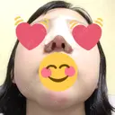 隆鼻術 / 鼻尖形成（切開） / 鼻中隔延長（切開） / 小鼻縮小（切開） / 軟骨移植 HANABI整形外科 DAY 2 サムネイル用