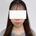 糸リフト / 脂肪吸引（顔） SEA CLINIC（シークリニック） DAY 75 サムネイル用