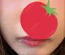 RF（高周波）たるみ治療 大塚美容形成外科 銀座本院 AFTER サムネイル用