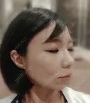 糸リフト / その他（輪郭） / ヒアルロン酸注入（鼻翼基部） 東京シンデレラ美容外科 池袋院 DAY 12 サムネイル用