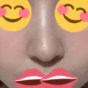 ヒアルロン酸注入（鼻翼基部） DMTC CLINIC 日本橋院 AFTER サムネイル用