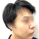 ルメッカ シェリークリニック 新宿本院 DAY 3 サムネイル用