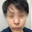 ルメッカ シェリークリニック 新宿本院 DAY 4 サムネイル用