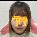 糸リフト / ヒアルロン酸注入（あご） / ボトックス（エラ・小顔） / 脂肪溶解注射（顔） 大阪TAクリニック DAY 14 サムネイル用
