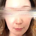 ハイフ（顔） 湘南美容クリニック 岐阜院 AFTER サムネイル用