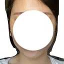 糸リフト / 脂肪吸引（顔） / ヒアルロン酸注入（あご） / ボトックス（エラ・小顔） 大阪TAクリニック DAY 1 サムネイル用