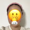 脂肪吸引（顔） 札幌ル・トロワ ビューティクリニックVogue DAY 21 サムネイル用