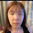 糸リフト / バッカルファット除去 / 脂肪吸引（顔） / 人中短縮 / 脂肪注入（額） / ジョールファット除去 / ヒアルロン酸注入（唇） BLINC CLINIC （ブリンク クリニック） DAY 6 サムネイル用