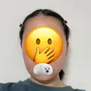 脂肪吸引（顔） 札幌ル・トロワ ビューティクリニックVogue DAY 28 サムネイル用