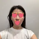 隆鼻術 / 鼻中隔延長（切開） / 鼻翼基部形成（貴族手術） ヴェリテクリニック 銀座院 DAY 43 サムネイル用