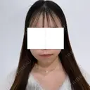糸リフト / 脂肪吸引（顔） SEA CLINIC（シークリニック） AFTER サムネイル用