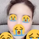 脂肪吸引（顔） / 額を丸く / 脂肪吸引（脚） / こめかみ形成 / 輪郭修正 / 脂肪注入（額） / 脂肪注入（輪郭） フレッシュ整形外科 DAY 25 サムネイル用