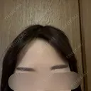 ボトックス（眉間） / ボトックス（額） 日本ウェルネス再生クリニック AFTER サムネイル用