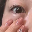 アートメイク（アイライン） Kinshicho Beauty Clinic （錦糸町ビューティークリニック） AFTER サムネイル用