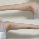 豊胸（シリコン＋脂肪併用） Casa de GRACIA GINZA 【カーサデグラシアギンザ】 DAY 119 サムネイル用