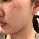 ルメッカ ルラ美容クリニック 大宮院 / ルラスキンクリニック 大宮院 DAY 0 サムネイル用