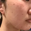 ルメッカ ルラ美容クリニック 大宮院 / ルラスキンクリニック 大宮院 DAY 0 サムネイル用