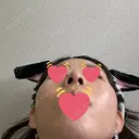 隆鼻術 / 鼻中隔延長（切開） / 鼻翼基部形成（貴族手術） ヴェリテクリニック 銀座院 DAY 70 サムネイル用