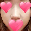 隆鼻術 / 鼻尖形成（切開） / 鼻中隔延長（切開） / 小鼻縮小（切開） / その他（鼻） / 骨切幅寄せ / 美容点滴・美容注射（美肌） FROM B整形外科 (旧バウム整形外科) DAY 15 サムネイル用
