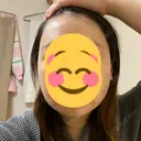 骨削り（エラ） / 脂肪吸引（顔） id（アイディ）美容外科 DAY 1 サムネイル用