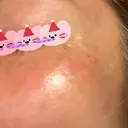 リジュラン 東京ココセランクリニック DAY 0 サムネイル用