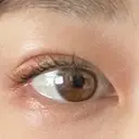 二重埋没 聖心美容クリニック 札幌院 DAY 7 サムネイル用