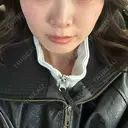 糸リフト / ヒアルロン酸注入（頬） EMMA CLINIC（エマクリニック） AFTER サムネイル用