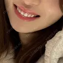 ガミースマイル手術 / その他（審美歯科/矯正歯科） / 矯正（ワイヤー） / セラミック 東京銀座A CLINIC デンタル DAY 463 サムネイル用