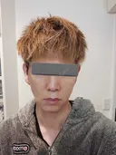 糸リフト / 脂肪吸引（顔） / ジョールファット除去 / 医療痩身（顔） / インディバ（顔） WOM CLINIC GINZA （ワム クリニック ギンザ） DAY 60 サムネイル用