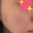 ルメッカ BIANCA表参道 DAY 4 サムネイル用