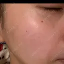 ルメッカ BIANCA表参道 DAY 11 サムネイル用