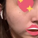 ルメッカ BIANCA表参道 DAY 21 サムネイル用