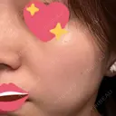 ルメッカ BIANCA表参道 DAY 21 サムネイル用